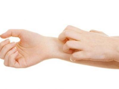 皮膚瘙癢的時候哪些藥膏止癢比較快