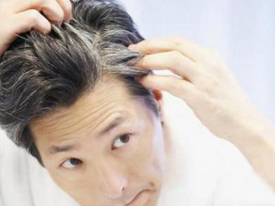 導致年輕人白發越長越多的兩種原因