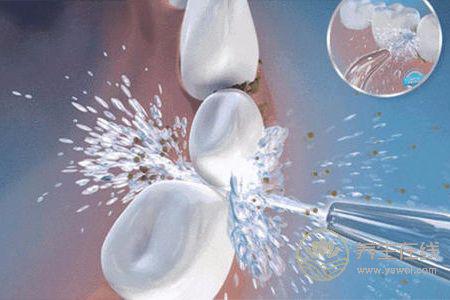 洗牙有什么好處?洗牙后注意事項有哪些?-易網健康<a href=http://www.xllyou.com/jkys/ target=_blank class=infotextkey>養生</a>網 洗牙有什么好處?洗牙后注意事項有哪些?