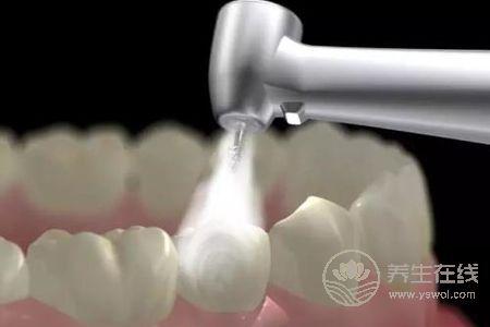 洗牙有什么好處?洗牙后注意事項有哪些?-易網<a href=http://www.xllyou.com/ target=_blank class=infotextkey>健康養生</a>網 洗牙有什么好處?洗牙后注意事項有哪些?