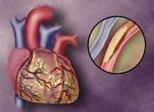 做好這三件事情可以讓你的甘油三酯指標降低
