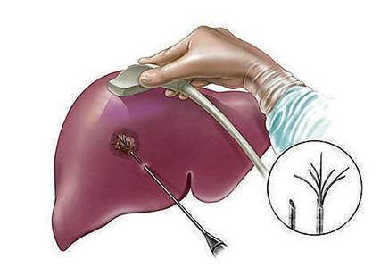 肝臟功能檢查的結果正確的解讀方法-易網健康<a href=http://www.xllyou.com/jkys/ target=_blank class=infotextkey>養生</a>網 肝臟功能檢查的結果正確的解讀方法