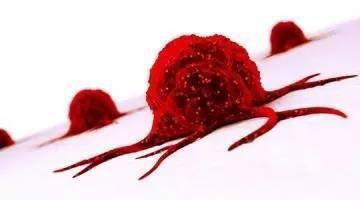 囊腫和腫瘤有什么區別囊腫會變成腫瘤嗎-易網健康<a href=http://www.xllyou.com/jkys/ target=_blank class=infotextkey>養生</a>網 囊腫和腫瘤有什么區別囊腫會變成腫瘤嗎