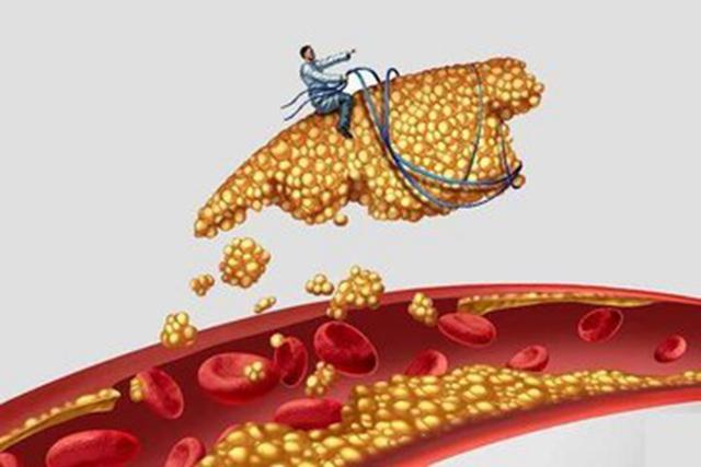甘油三酯高的原因以及如何降低甘油三酯-易網健康<a href=http://www.xllyou.com/jkys/ target=_blank class=infotextkey>養生</a>網 甘油三酯高的原因以及如何降低甘油三酯