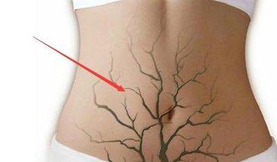 有哪些簡單高效的一天清腸的方法-易網(wǎng)健康<a href=http://www.xllyou.com/jkys/ target=_blank class=infotextkey>養(yǎng)生</a>網(wǎng) 有哪些簡單高效的一天清腸的方法