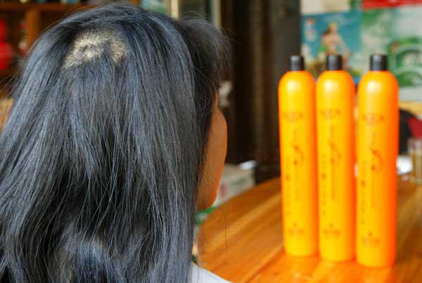 導致頭發變黃脫發的幾種常見原因-易網健康<a href=http://www.xllyou.com/jkys/ target=_blank class=infotextkey>養生</a>網 導致頭發變黃脫發的幾種常見原因