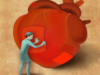 心衰具體分為哪幾種類型心衰可以治好嗎