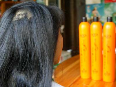 導(dǎo)致頭發(fā)變黃脫發(fā)的幾種常見原因