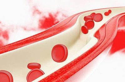 降壓藥分為哪些種類降壓藥的區別是什么