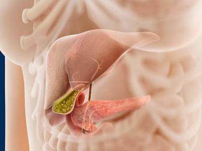 結(jié)石患者在生活中可以多吃核桃嗎