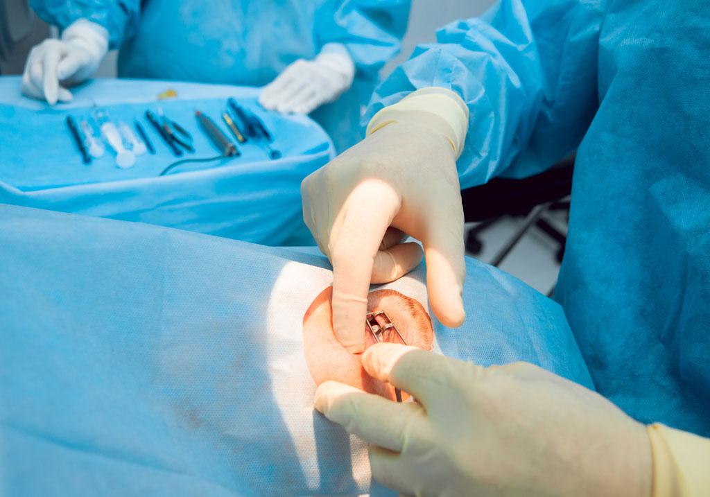 準(zhǔn)分子和飛秒哪種手術(shù)方式的對(duì)眼睛更好-易網(wǎng)健康<a href=http://www.xllyou.com/jkys/ target=_blank class=infotextkey>養(yǎng)生</a>網(wǎng) 準(zhǔn)分子和飛秒哪種手術(shù)方式的對(duì)眼睛更好