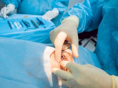 準分子和飛秒哪種手術方式的對眼睛更好