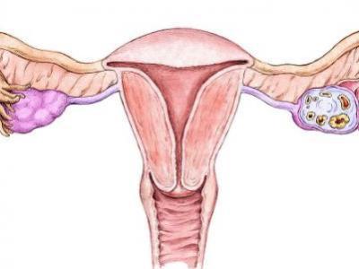 女性想要保持年輕那么卵巢一定要保護好