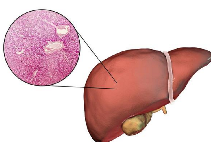 肝臟不好的人早晨起床會有這六個癥狀