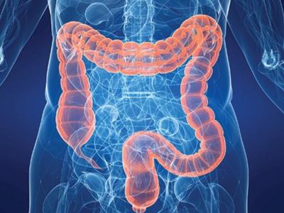 如果你出現(xiàn)這三個(gè)異常說(shuō)明有可能是腸癌