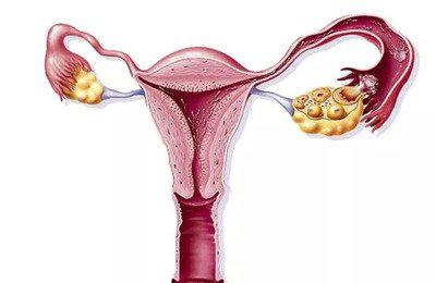 導(dǎo)致卵巢提前走向衰老的原因有哪些-易網(wǎng)健康<a href=http://www.xllyou.com/jkys/ target=_blank class=infotextkey>養(yǎng)生</a>網(wǎng) 導(dǎo)致卵巢提前走向衰老的原因有哪些