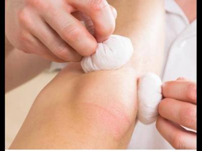 類風濕關節炎手術和吃藥治療的區別