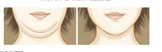 為什么會長雙下巴的幾種原因-易網健康<a href=http://www.xllyou.com/jkys/ target=_blank class=infotextkey>養生</a>網 為什么會長雙下巴的幾種原因