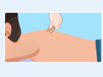 三伏天刮痧拔罐的好處和壞處 拔罐和刮痧哪個去濕氣