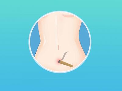 三伏天小兒艾灸肚臍的好處 小兒臍灸的優點