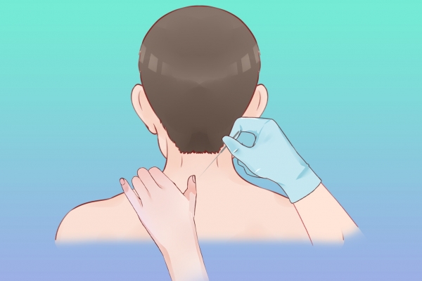 三伏天可以天天艾灸背嗎 三伏天艾灸背的好處-易網健康養生網 三伏天可以天天艾灸背嗎 三伏天艾灸背的好處