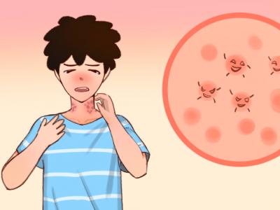 白茯苓和土茯苓祛濕哪個好 白茯苓和土茯苓的功效