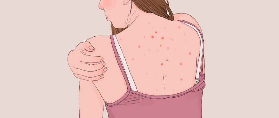 喝祛濕茶要多久有效果 祛濕茶的好處和作用-易網健康<a href=http://www.xllyou.com/jkys/ target=_blank class=infotextkey>養生</a>網 喝祛濕茶要多久有效果 祛濕茶的好處和作用