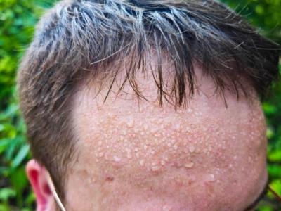 肝火旺可以汗蒸出汗嗎 一動(dòng)就出汗跟肝火旺有關(guān)系嗎