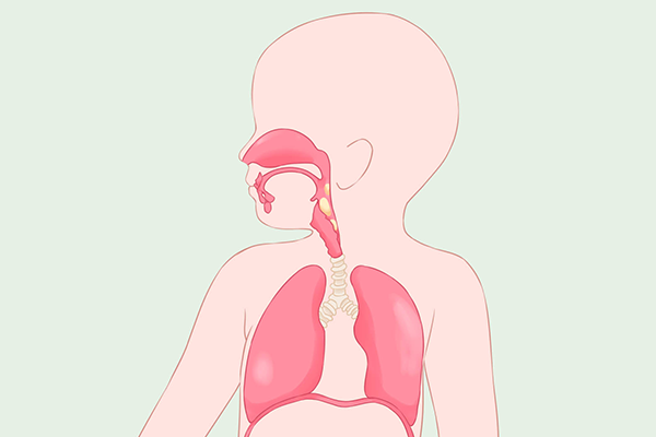 得了痙攣型腦癱會有哪些癥狀-易網健康養生網 得了痙攣型腦癱會有哪些癥狀