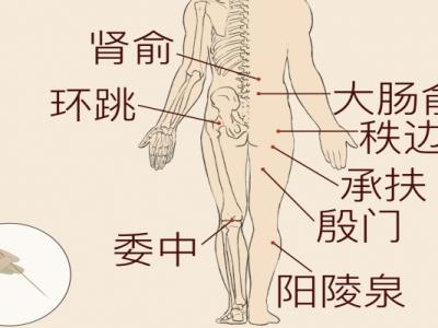 哪些中藥治療腰間盤突出