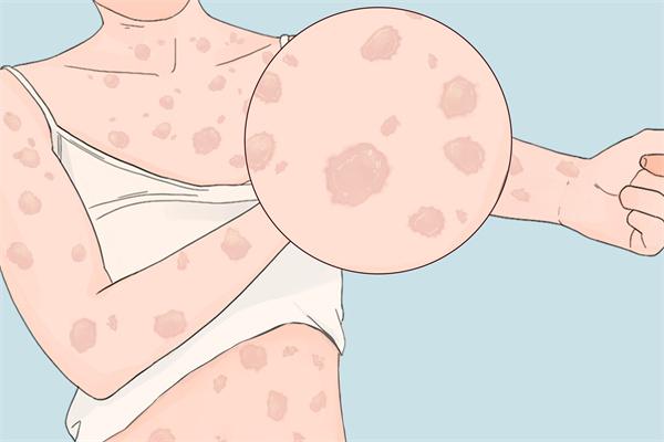 吃羊肉會過敏嗎-易網(wǎng)<a href=http://www.xllyou.com/ target=_blank class=infotextkey>健康養(yǎng)生</a>網(wǎng) 吃羊肉會過敏嗎