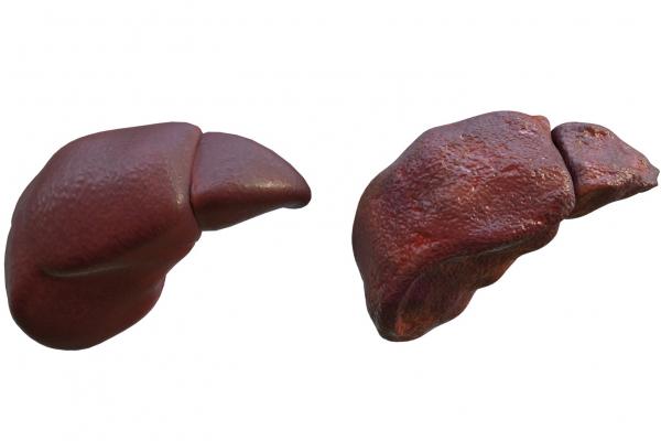 肝硬化能吃羊肉嗎-易網(wǎng)健康<a href=http://www.xllyou.com/jkys/ target=_blank class=infotextkey>養(yǎng)生</a>網(wǎng) 肝硬化能吃羊肉嗎