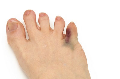 糖尿病足治療最好的醫院 盤點糖尿病足十大醫院