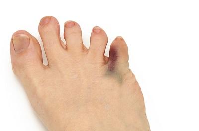 糖尿病足治療最好的醫(yī)院 盤點糖尿病足十大醫(yī)院