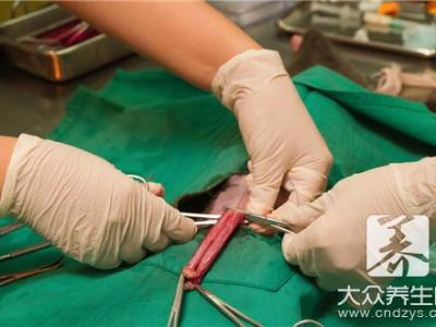 摘環之前可以同房嗎