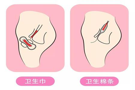 衛生棉條解放女性自由 許多人卻擔心它會弄破處女膜?-易網<a href=http://www.xllyou.com/ target=_blank class=infotextkey>健康養生</a>網 衛生棉條解放女性自由 許多人卻擔心它會弄破處女膜?