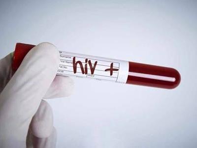 艾滋病并沒有初期癥狀,如何預防艾滋病要記住這一點