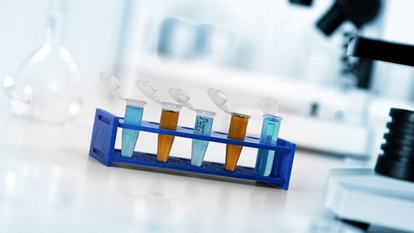 性激素六項檢查注意事項有哪些 性激素六項的參考范圍是什么-易網(wǎng)健康<a href=http://www.xllyou.com/jkys/ target=_blank class=infotextkey>養(yǎng)生</a>網(wǎng) 性激素六項檢查注意事項有哪些 性激素六項的參考范圍是什么