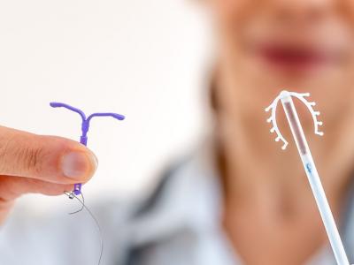 宮內節育環是什么 功能節育環的5個好處