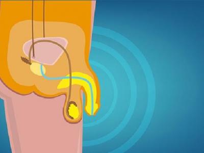 男性遺精誘發因素有哪些 你知道什么情況屬于遺精嗎