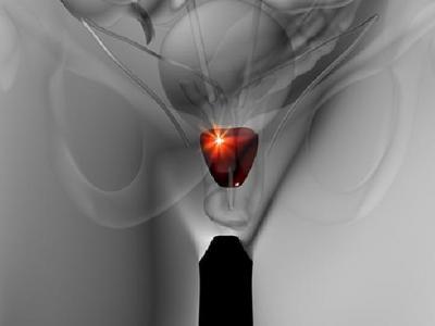 你真的知道遺精是什么嗎? 男性遺精要注意這些事項