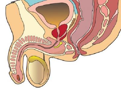 男性性功能障礙怎么得的 男性性功能障礙治療的七個要點
