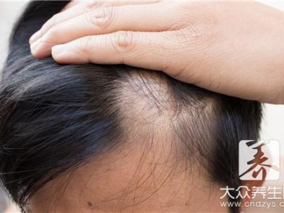 縱欲過度掉頭發(fā)還長嗎