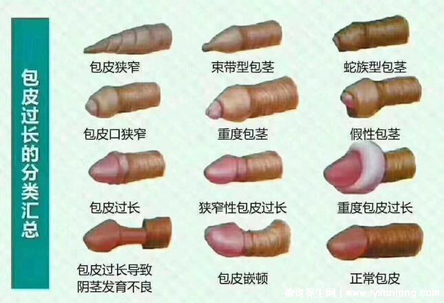 老公割包之后好像沒有那么厲害了,因為更敏感了(5個原因)-易網(wǎng)<a href=http://www.xllyou.com/ target=_blank class=infotextkey>健康養(yǎng)生</a>網(wǎng) 老公割包之后好像沒有那么厲害了,因為更敏感了(5個原因)