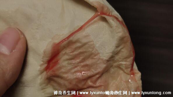 懷孕剛著床的6個(gè)反應(yīng)，月經(jīng)前一星期懷孕跡象(附著床出血圖片)