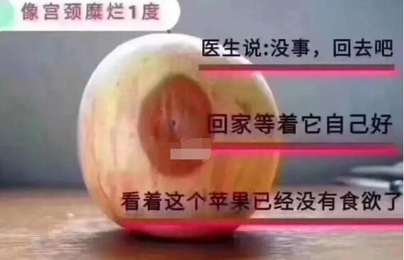 宮頸糜爛一二三度圖片,真實對比照片(小心是宮頸癌前兆)-易網<a href=http://www.xllyou.com/ target=_blank class=infotextkey>健康養(yǎng)生</a>網 宮頸糜爛一二三度圖片,真實對比照片(小心是宮頸癌前兆)