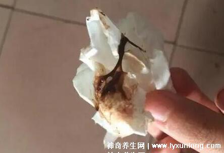 宮頸糜爛一二三度圖片,真實對比照片(小心是宮頸癌前兆)-易網健康養(yǎng)生網 宮頸糜爛一二三度圖片,真實對比照片(小心是宮頸癌前兆)