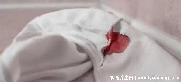 真實宮頸癌的早期出血圖片,接觸性出血是最明顯癥狀(女性必看)-易網健康養生網 真實宮頸癌的早期出血圖片,接觸性出血是最明顯癥狀(女性必看)