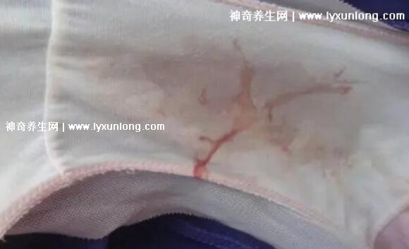 真實宮頸癌的早期出血圖片,接觸性出血是最明顯癥狀(女性必看)-易網<a href=http://www.xllyou.com/ target=_blank class=infotextkey>健康養生</a>網 真實宮頸癌的早期出血圖片,接觸性出血是最明顯癥狀(女性必看)