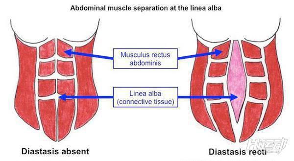 產后肚子變松弛，常規減脂不頂用！3步找回平坦腹肌